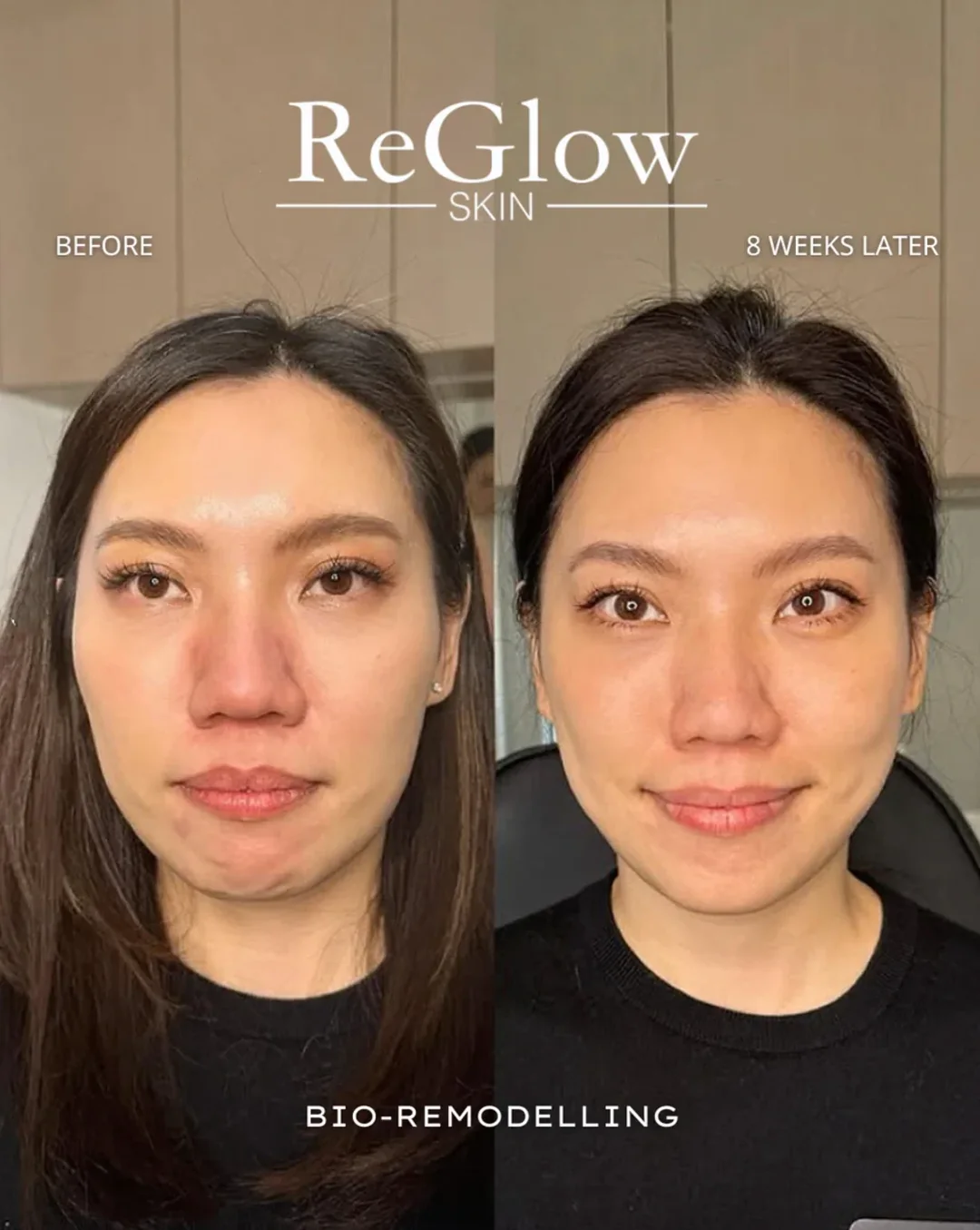 Bio-remodelling service imagery showing a front-facing portrait comparison