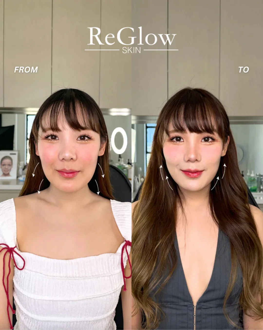 Ultraformer service imagery showing a front-facing portrait comparison