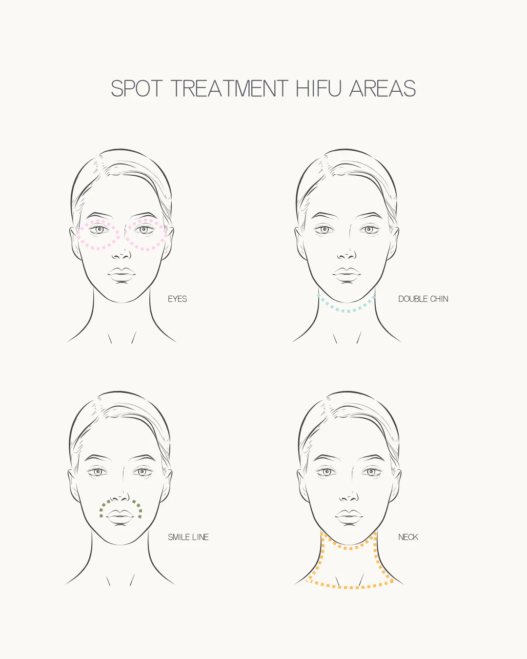 Ultraformer III HIFU applied to a single targeted spot