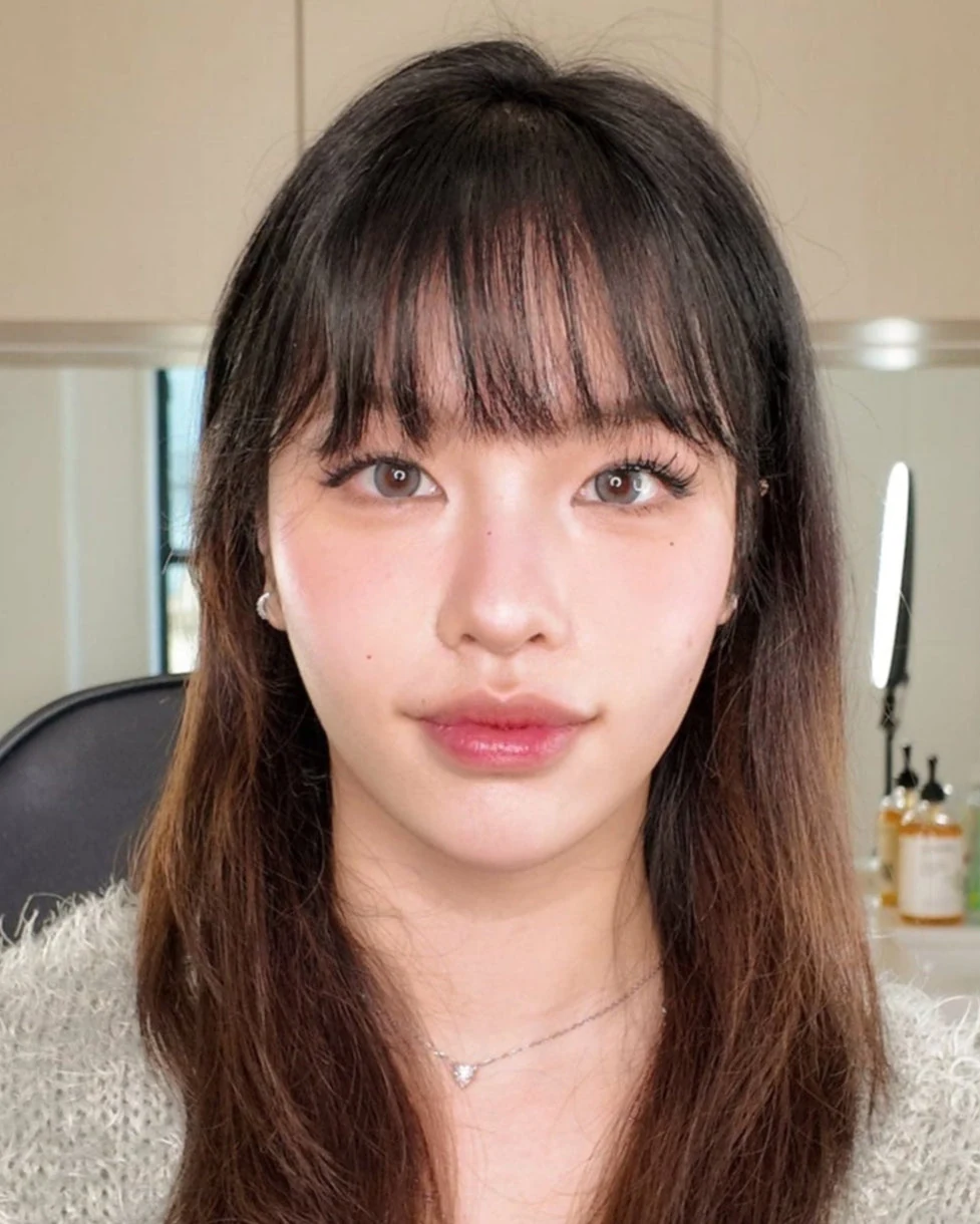 Chin projection and jawline definition, an area treated with dermal fillers