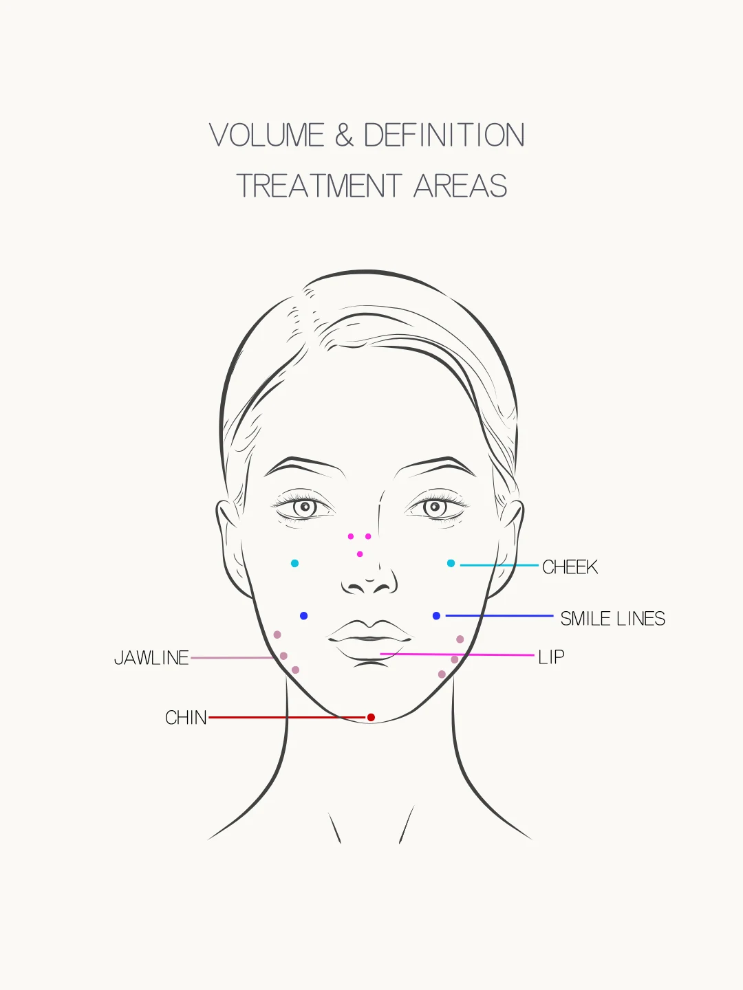 Illustrated guide to the facial areas treated with dermal fillers