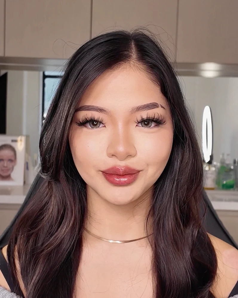 Lip shape, border and volume shown front-facing